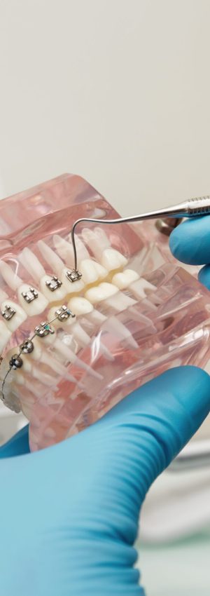 Prosthetics hands while working on the denture, false teeth, a study and a table with dental tools. Dental laboratory.