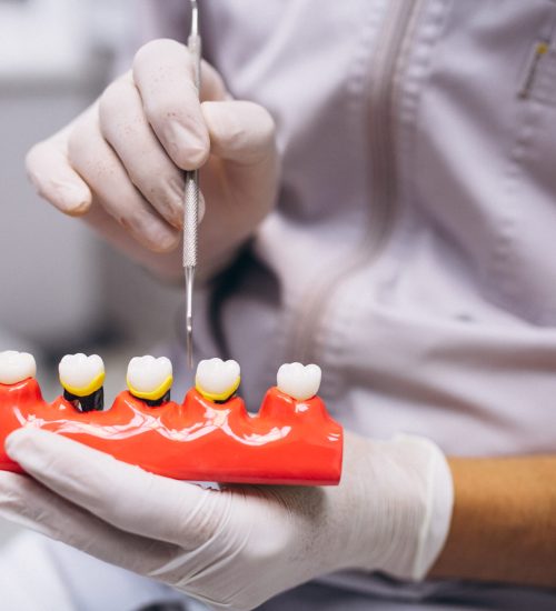 Woman patient at dentist